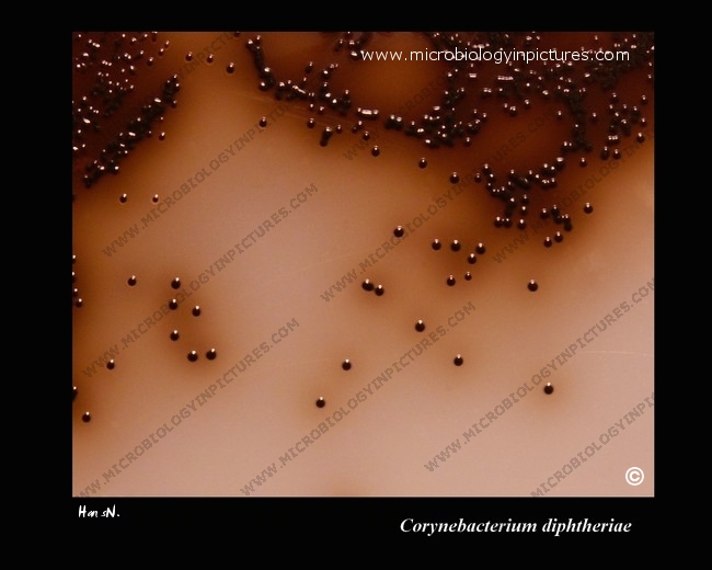 C.diphtheriae cystinase activity on Tinsdale agar c.diphtheriae colonies surrounded by black halo on Tinsdale agar